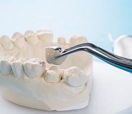 Crown being placed on a clay model