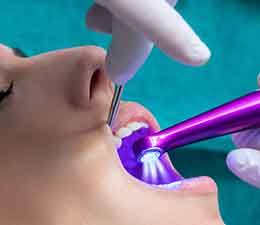 Woman getting a dental sealant