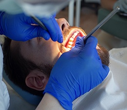 A dentist applying antibiotic gel to a patient’s gums